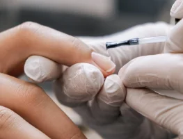 Выравнивание ногтевой пластины — БЕСПЛАТНО