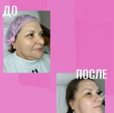 Студия эпиляции и косметологии Toplaser pro Moscow фото 6