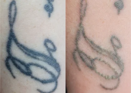 Сидельца мордовской колонии оштрафовали за экстремистские татуировки на коленях